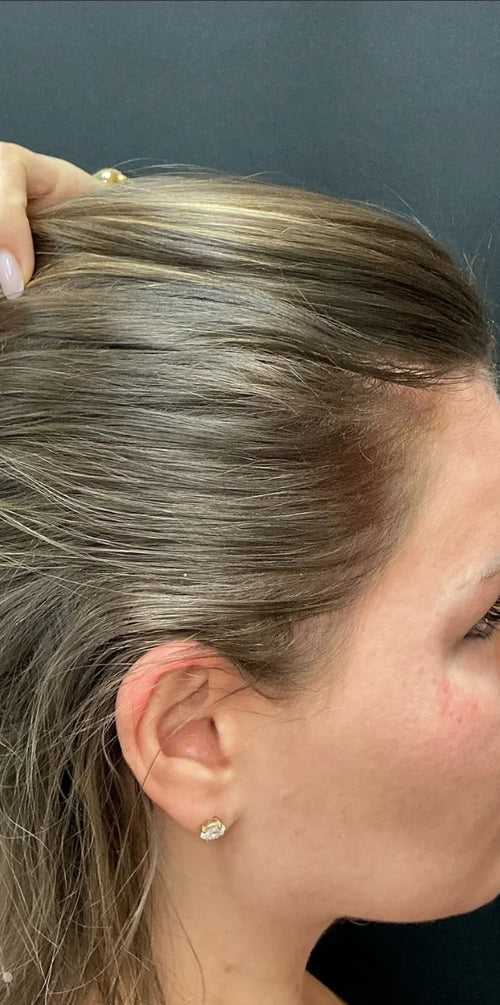 Emily J. - After