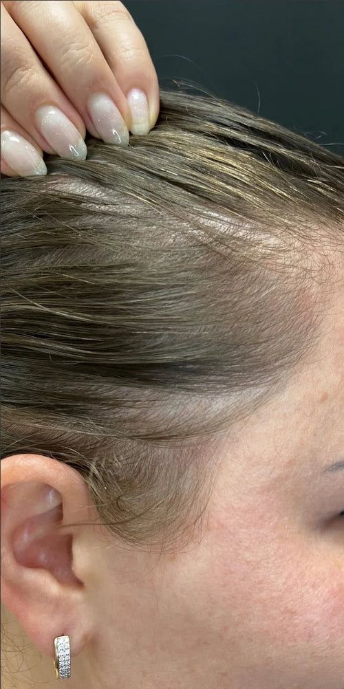 Emily J. - Before